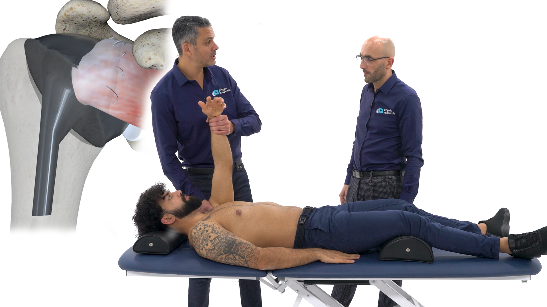 Prothèse : définition, types, pose et rééducation expliqués
